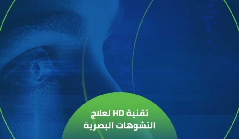 تقنية HD لعلاج التشوهات البصرية