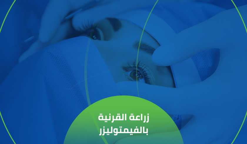زراعة القرنية بالفيمتو ليزر