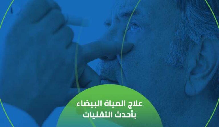 علاج المياه البيضاء بأحدث التقنيات