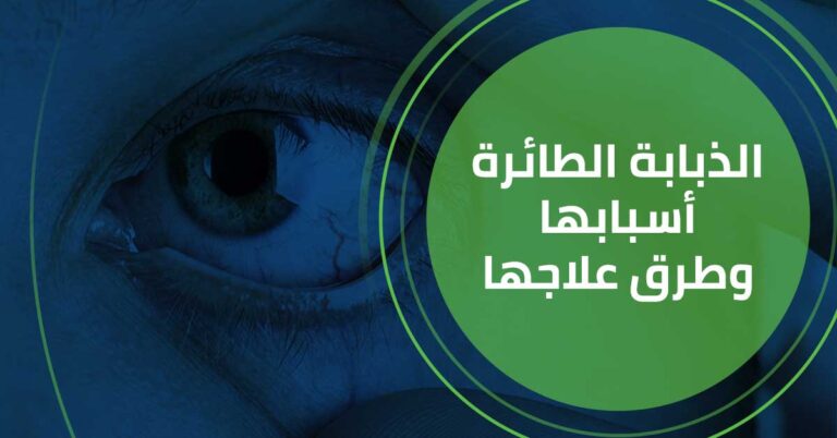 الذبابة الطائرة اسبابها و طرق علاجها