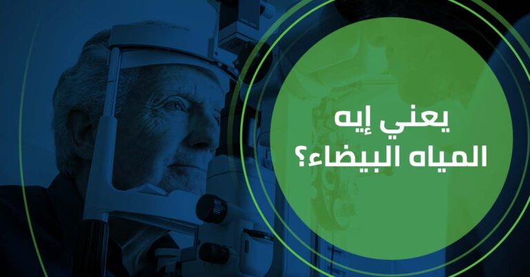 يعني ايه المياه البيضاء ؟