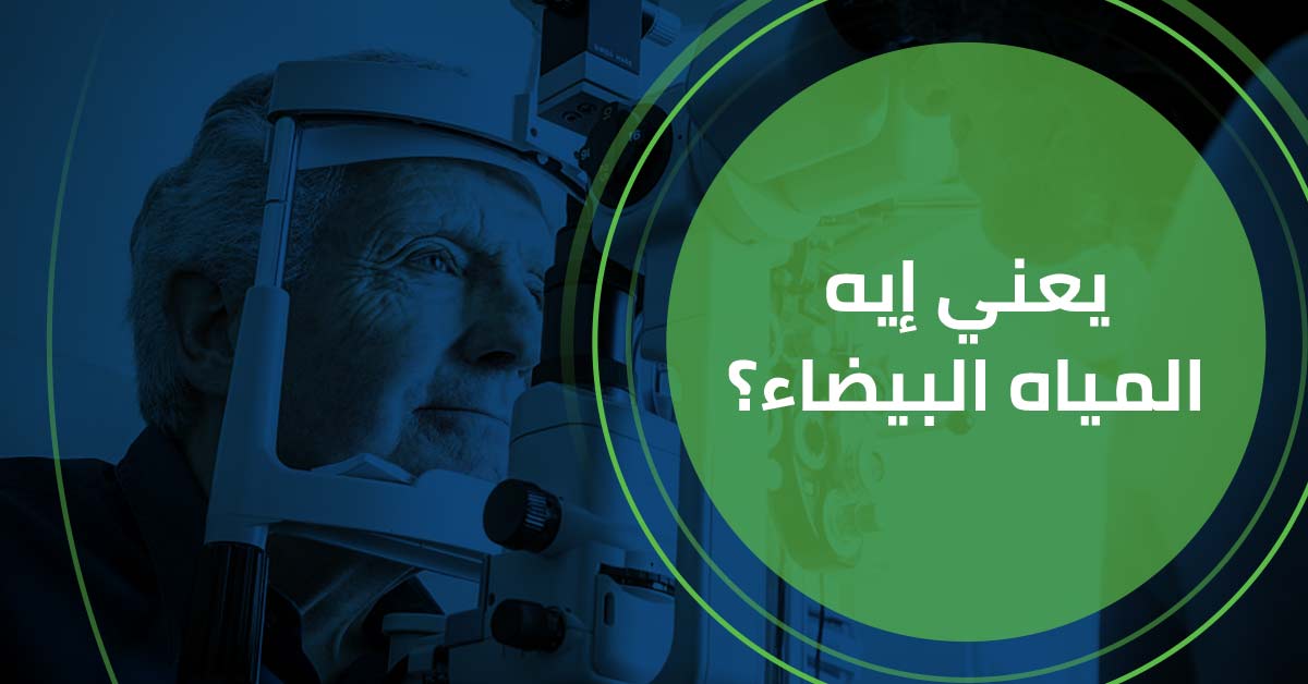 يعني ايه المياه البيضاء ؟