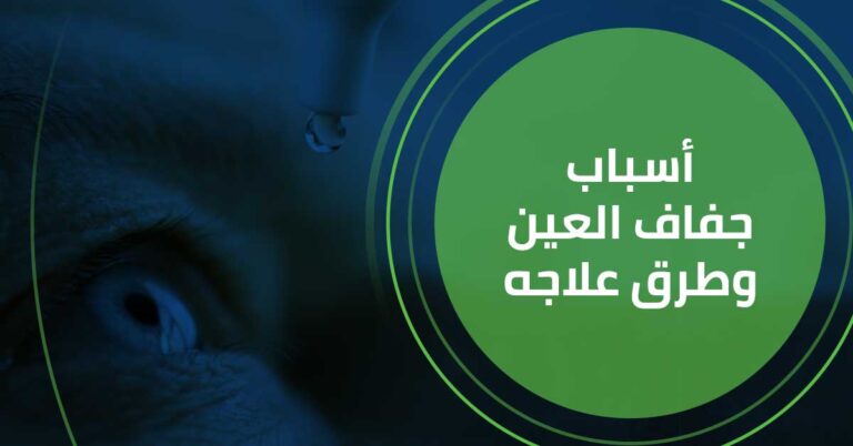اسباب جفاف العين و طرق علاجه