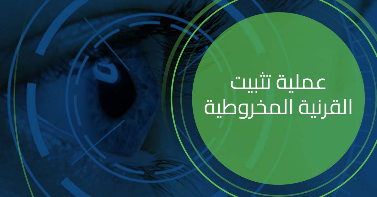 ما هي عملية تثبيت القرنية المخروطية ؟