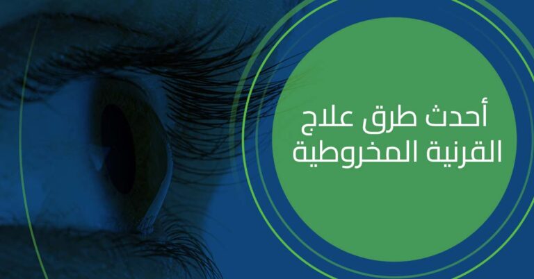 احدث طرق علاج القرنية المخروطية