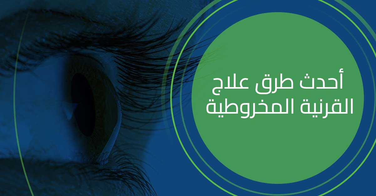 احدث طرق علاج القرنية المخروطية