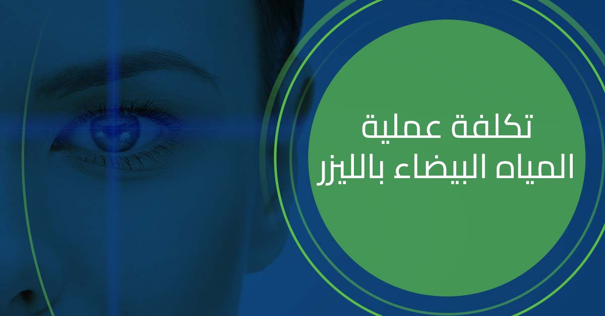 تكلفة عملية المياه البيضاء بالليزر