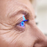 الأوكتافيوس ليزك Octavius LASIK | أحدث تقنيات تصحيح الإبصار بدقة عالية