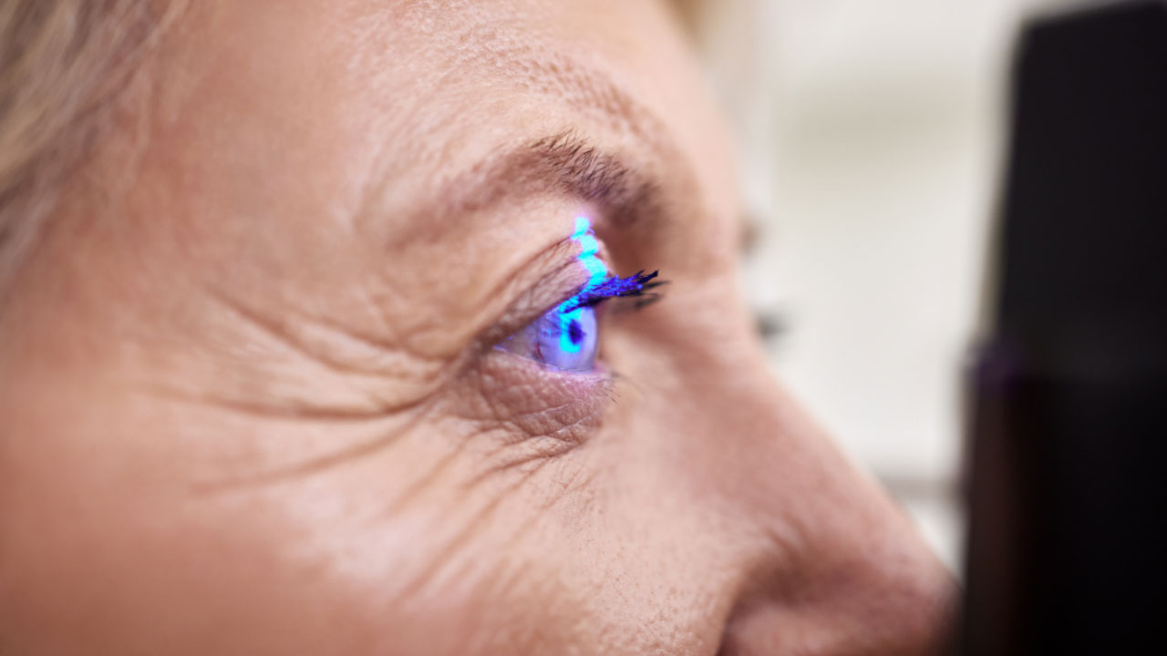 الأوكتافيوس ليزك Octavius LASIK | أحدث تقنيات تصحيح الإبصار بدقة عالية