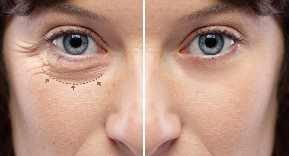 اكتشف خدمات تجميل العيون وشد الجفون لتحسين المظهر والحفاظ على الوظيفة الطبيعية للعين بأحدث التقنيات.